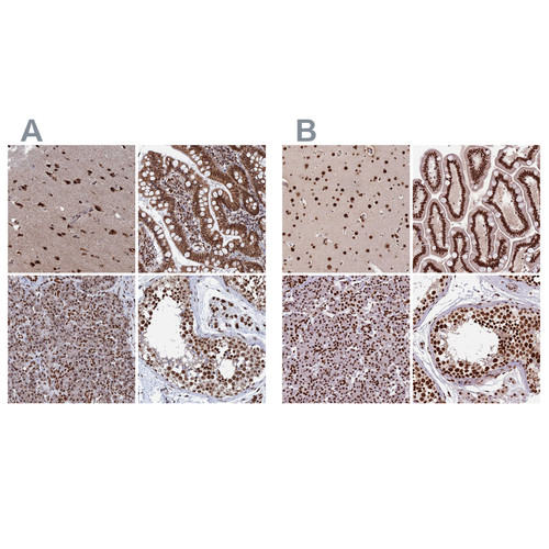 Immunohistochemical staining of human cerebral cortex, gastrointestinal, pancreas and testis using Anti-CTB-50L17.10 antibody HPA042559 (A) shows similar protein distribution across tissues to independent antibody HPA044208 (B).