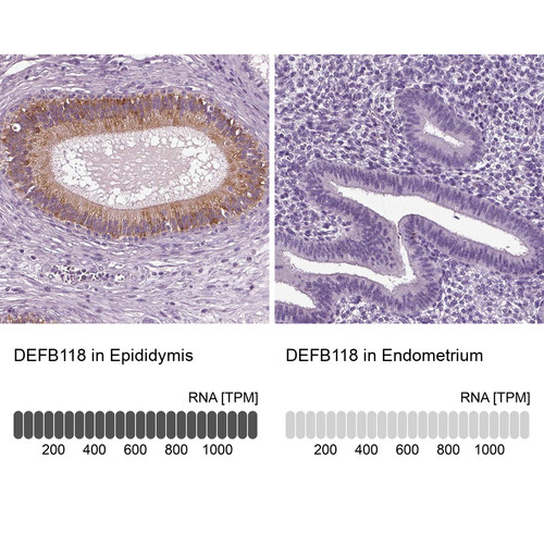 Immunohistochemistry analysis in human epididymis and endometrium tissues using Anti-DEFB118 antibody. Corresponding DEFB118 RNA-seq data are presented for the same tissues.