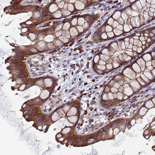 Immunohistochemical staining of human rectum shows strong cytoplasmic positivity in glandular cells.