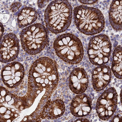 Immunohistochemical staining of human colon shows strong cytoplasmic positivity in glandular cells.