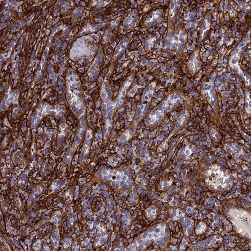 Immunohistochemical staining of human spleen shows strong positivity in vessels. 