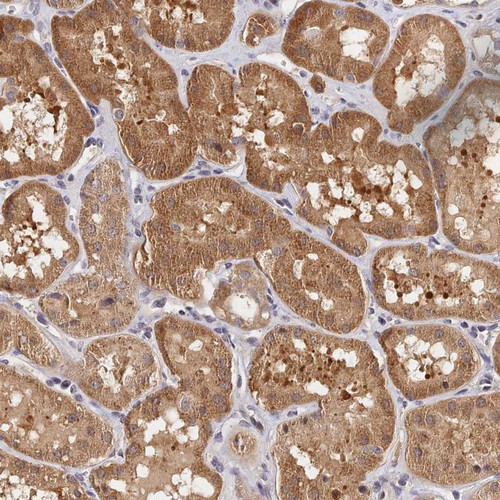 Immunohistochemical staining of human kidney shows moderate cytoplasmic positivity in cells in tubules.