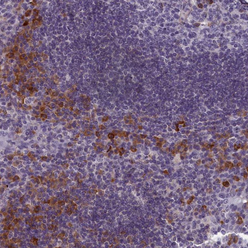 Immunohistochemical staining of human tonsil shows strong cytoplasmic positivity in subsets of cells outside germinal center.