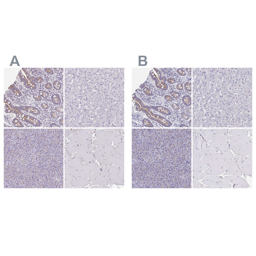Immunohistochemical staining of human gastrointestinal, liver, pancreas and skeletal muscle using Anti-CHMP5 antibody HPA042883 (A) shows similar protein distribution across tissues to independent antibody HPA056437 (B).