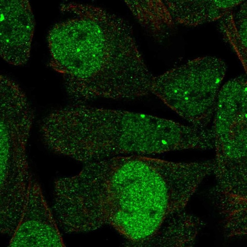 Immunofluorescent staining of human cell line RH-30 shows localization to nucleoplasm & nuclear bodies.