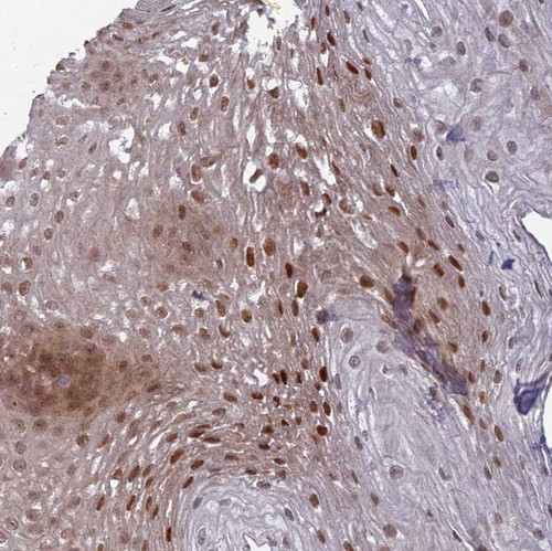 Immunohistochemical staining of human Esophagus shows moderate nuclear positivity in squamous epithelial cells.