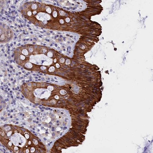 Immunohistochemical staining of human rectum shows strong cytoplasmic and membranous positivity in glandular cells.