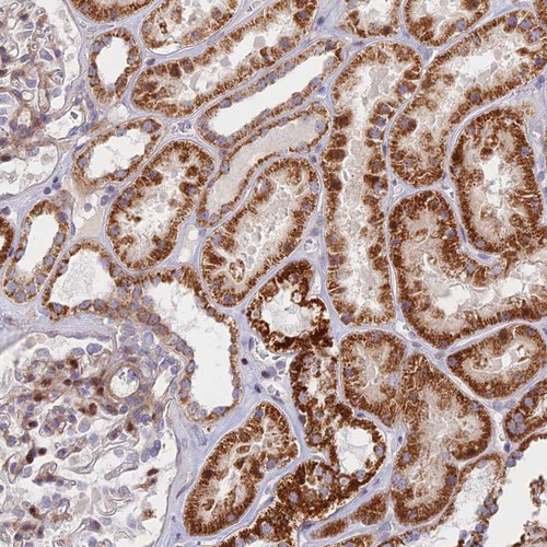 Immunohistochemical staining of human kidney shows strong cytoplasmic positivity in cells in tubules.