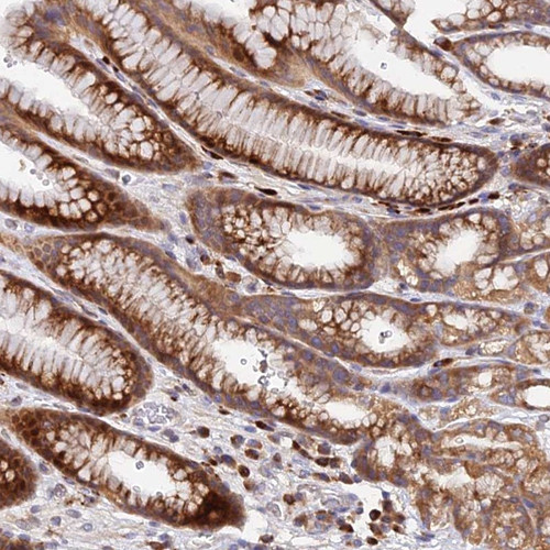 Immunohistochemical staining of human stomach, lower shows strong cytoplasmic positivity in glandular cells.