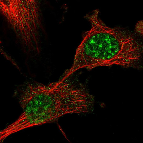 Immunofluorescent staining of human cell line U-251 MG shows positivity in nucleus.