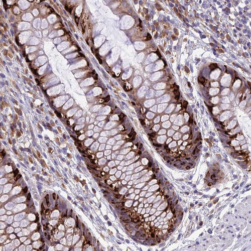 Immunohistochemical staining of human rectum shows strong cytoplasmic positivity in goblet cells.