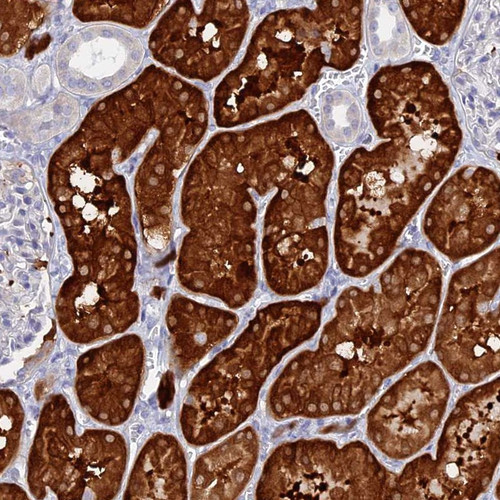 Immunohistochemical staining of human kidney shows strong cytoplasmic positivity in cells in tubules.