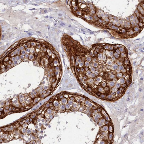 Immunohistochemical staining of human testis shows strong cytoplasmic positivity in a subset of cells in seminiferous ducts. .