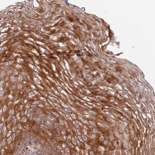 Immunohistochemical staining of human esophagus shows moderate cytoplasmic positivity in squamous epithelial cells.