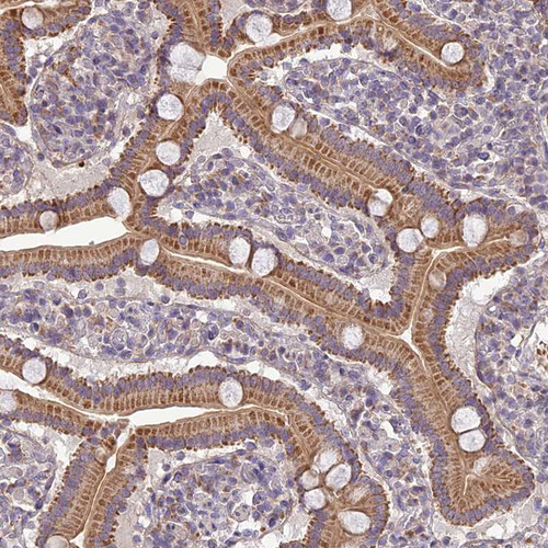 Immunohistochemical staining of human duodenum shows moderate cytoplasmic positivity in glandular cells.