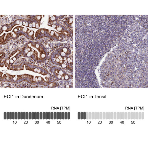 Immunohistochemistry analysis in human duodenum and tonsil tissues using HPA043227 antibody. Corresponding ECI1 RNA-seq data are presented for the same tissues.