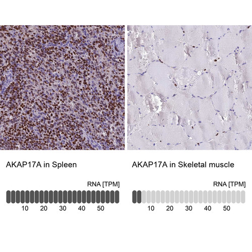 Immunohistochemistry analysis in human spleen and skeletal muscle tissues using Anti-AKAP17A antibody. Corresponding AKAP17A RNA-seq data are presented for the same tissues.