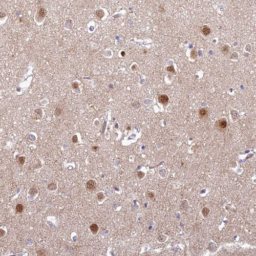 Immunohistochemical staining of human rectum shows moderate nuclear positivity in glandular cells.