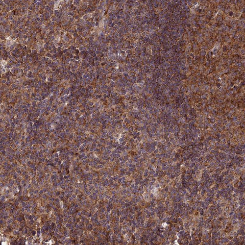 Immunohistochemical staining of human colon shows strong granular cytoplasmic positivity in glandular cells.
