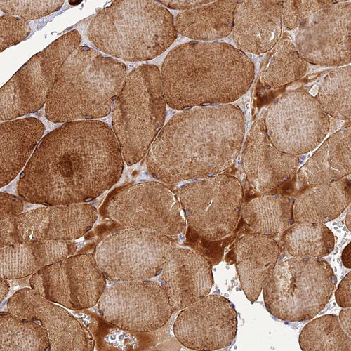 Immunohistochemical staining of human skeletal muscle shows moderate cytoplasmic positivity in myocytes.
