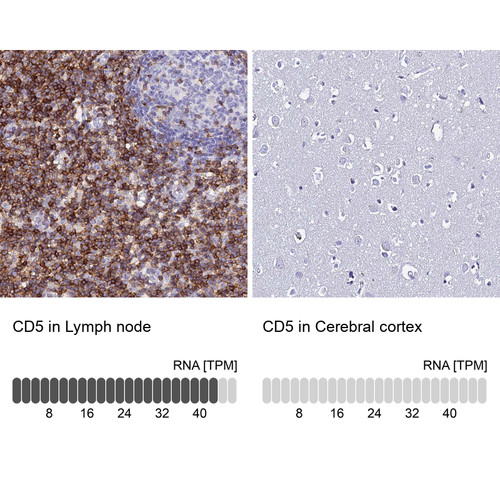Immunohistochemistry analysis in human lymph node and cerebral cortex tissues using Anti-CD5 antibody. Corresponding CD5 RNA-seq data are presented for the same tissues.