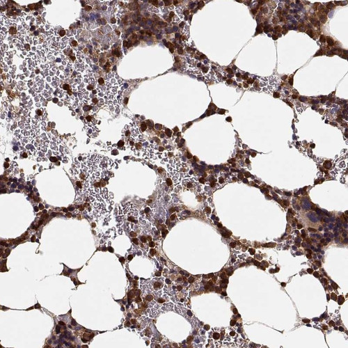 Immunohistochemical staining of human bone marrow shows strong positivity in hematopoietic cells.