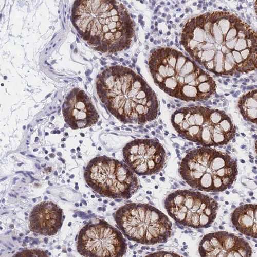 Immunohistochemical staining of human colon shows strong cytoplasmic positivity in glandular cells.
