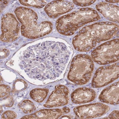 Immunohistochemical staining of human kidney shows strong cytoplasmic positivity in cells in tubules.