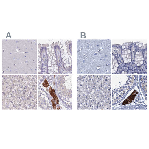 Immunohistochemical staining of human cerebral cortex, colon, liver and testis using Anti-CYP51A1 antibody HPA043508 (A) shows similar protein distribution across tissues to independent antibody HPA041325 (B).