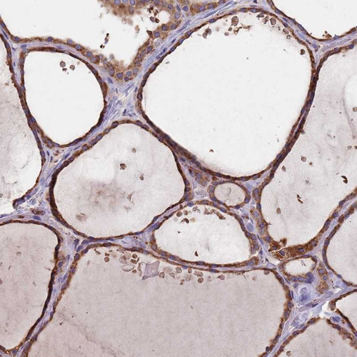 Immunohistochemical staining of human thyroid gland shows strong cytoplasmic positivity in glandular cells.
