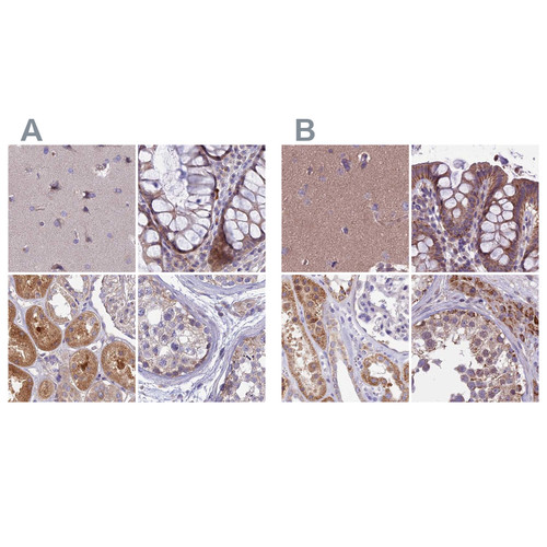 Immunohistochemical staining of human cerebral cortex, colon, kidney and testis using Anti-DUS2 antibody HPA043528 (A) shows similar protein distribution across tissues to independent antibody HPA042560 (B).