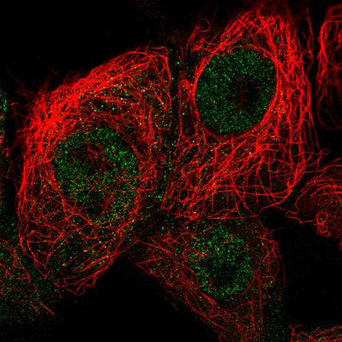 Immunofluorescent staining of human cell line A-431 shows localization to nucleoplasm.