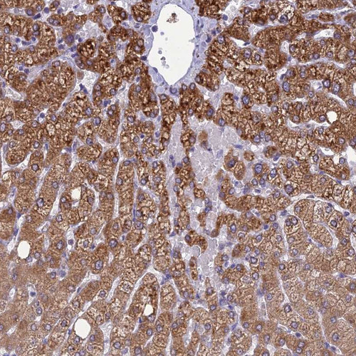 Immunohistochemical staining of human liver shows strong cytoplasmic positivity in hepatocytes.
