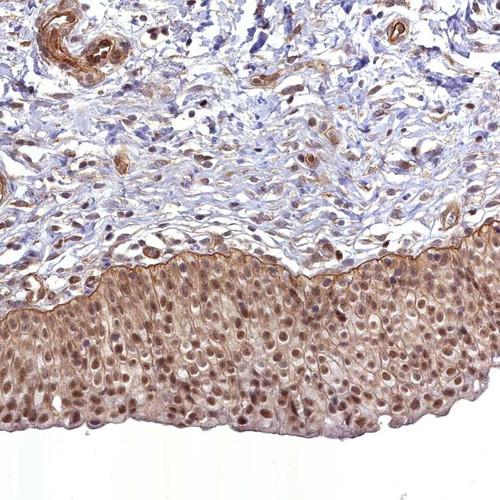 Immunohistochemical staining of human urinary bladder shows moderate cytoplasmic, membranous and nuclear positivity in urothelial cells.