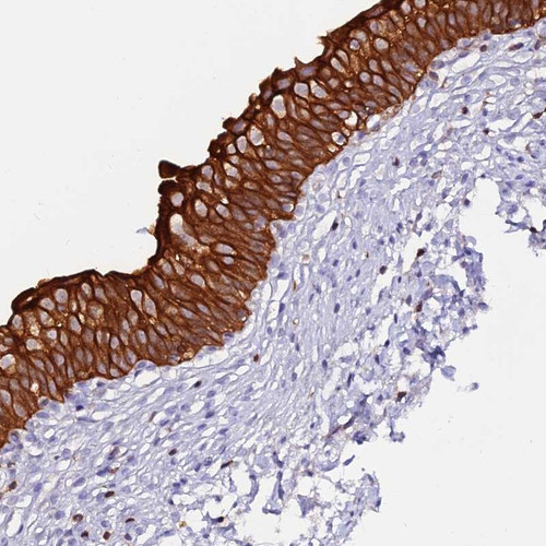 Immunohistochemical staining of human urinary bladder shows strong cytoplasmic and membranous positivity in urothelium.