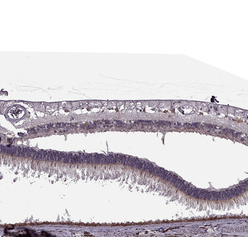 Immunohistochemical staining of human retina shows weak to moderate cytoplasmic positivity in ganglion cell layer.