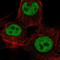 Immunofluorescent staining of human cell line SuSa shows localization to nucleoplasm.