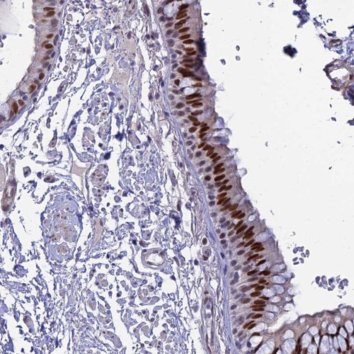 Immunohistochemical staining of human bronchus shows strong nuclear positivity in respiratory epithelial cells.