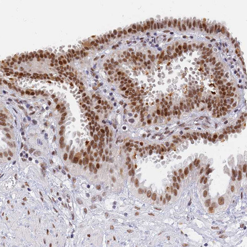 Immunohistochemical staining of human fallopian tube shows moderate to strong nuclear positivity in glandular cells.