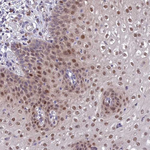 Immunohistochemical staining of human esophagus shows moderate nuclear positivity in squamous epithelial cells.