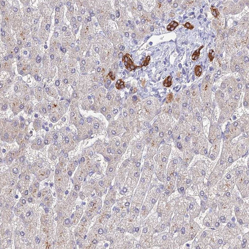 Immunohistochemical staining of human liver shows strong cytoplasmic positivity in bile duct cells.