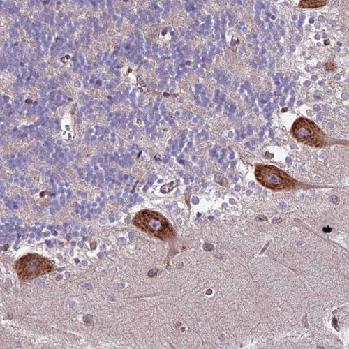 Immunohistochemical staining of human cerebellum shows strong cytoplasmic positivity in Purkinje cells.
