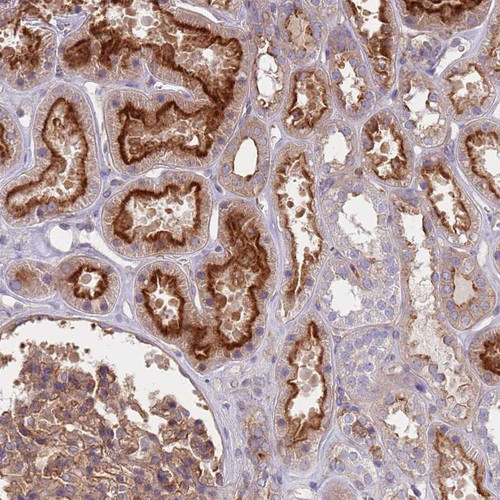 Immunohistochemical staining of human kidney shows strong membranous positivity in cells in tubules.