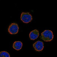 Immunofluorescent staining of human cell line HEL shows localization to cytosol.