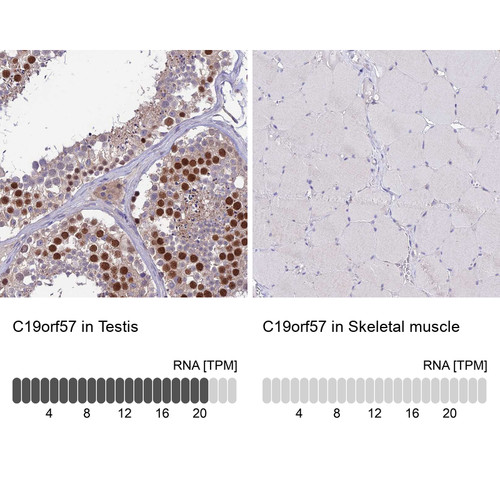 Immunohistochemistry analysis in human testis and skeletal muscle tissues using Anti-C19orf57 antibody. Corresponding C19orf57 RNA-seq data are presented for the same tissues.