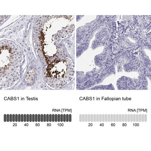 Immunohistochemistry analysis in human testis and fallopian tube tissues using Anti-CABS1 antibody. Corresponding CABS1 RNA-seq data are presented for the same tissues.