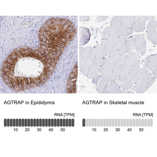 Immunohistochemistry analysis in human epididymis and skeletal muscle tissues using HPA044120 antibody. Corresponding AGTRAP RNA-seq data are presented for the same tissues.