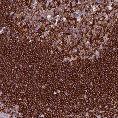 Immunohistochemical staining of human tonsil shows strong cytoplasmic positivity in non-germinal center cells.