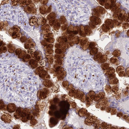 Immunohistochemical staining of human small intestine shows strong cytoplasmic positivity in glandular cells.