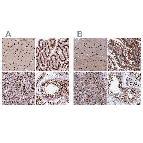 Immunohistochemical staining of human cerebral cortex, gastrointestinal, pancreas and testis using Anti-CTB-50L17.10 antibody HPA044208 (A) shows similar protein distribution across tissues to independent antibody HPA042559 (B).